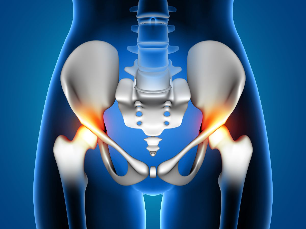 Hip Replacement